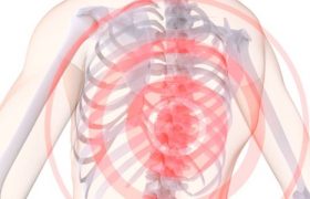 Как лечить шейно-грудной остеохондроз