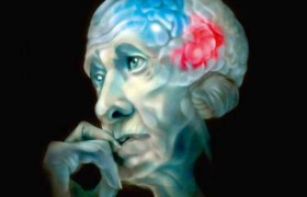 Создана вакцина от болезни Альцгеймера