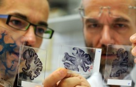 Специалистам из США удалось создать лекарство от болезни Альцгеймера