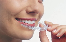 Хотите исправить прикус? Пластинки на зубы помогут!