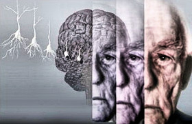 Обнаружены гены которые отвечают за болезнь Альцгеймера