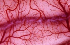 Стресс может навредить сосудам