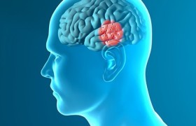 FDA одобрило к применению мозговой стимулятор для пациентов, страдающих от болезни Паркинсона