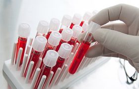 Анализ крови поможет выявить болезнь Паркинсона