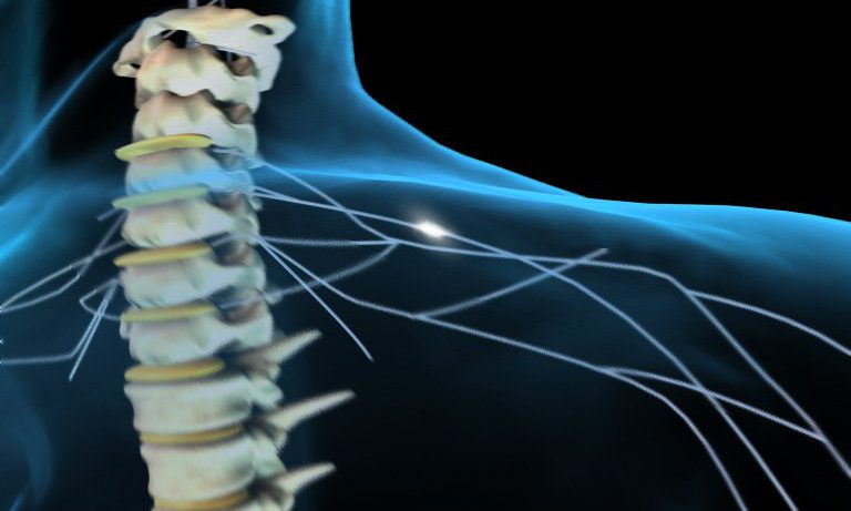Электростимуляция спинного мозга позволила пошевелить ногами парализованным людям