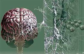 Ягоды черники могут помочь снизить риск развития болезни Альцгеймера