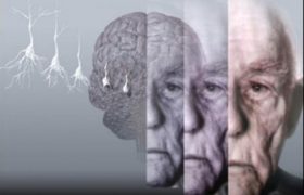 Простуда на губах повышает риск болезни Альцгеймера