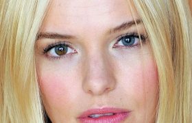 Анизокория