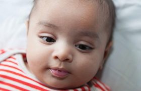 Фенилкетонурия. Лечение