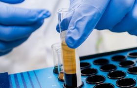 Почему стресс становится депрессией