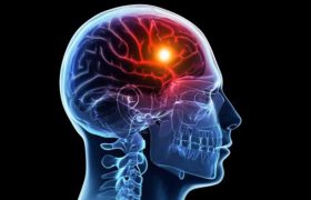 Лечение отдаленных последствий черепно-мозговой травмы