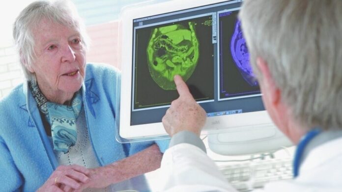 Ученые выяснили, как остановить развитие болезни Альцгеймера