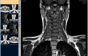 Дорого ли делать МРТ шейного отдела позвоночника: цена в СПб