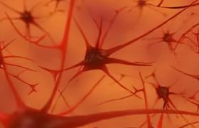 Аксональная полинейропатия