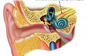 Вестибулярный нейронит