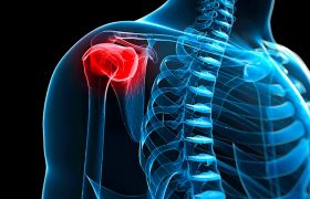 Плечевой периартрит