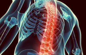 Борьба с остеопорозом: как сделать кости более крепкими