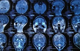 Возможности и преимущества обследования МРТ шеи и головного мозга
