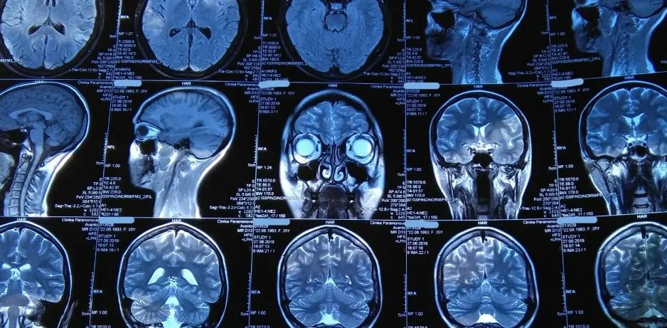 Возможности и преимущества обследования МРТ шеи и головного мозга