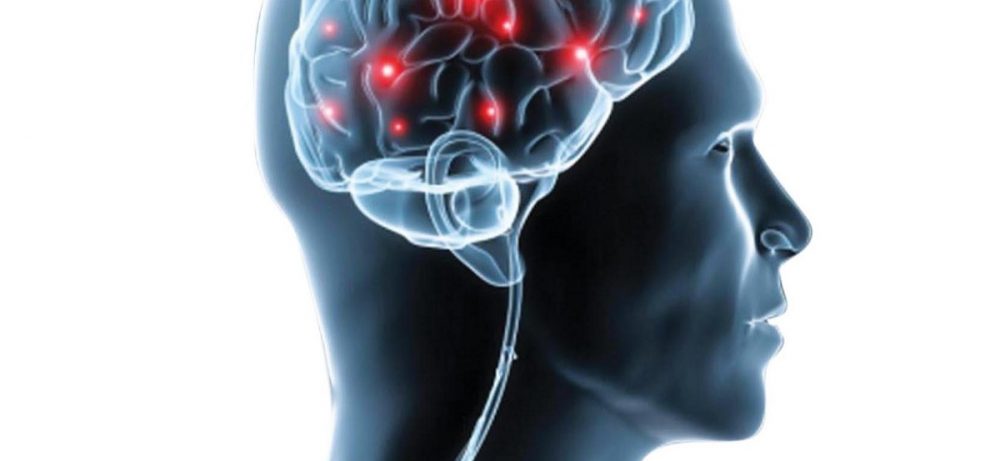 Причины возникновения и способы лечения головной боли