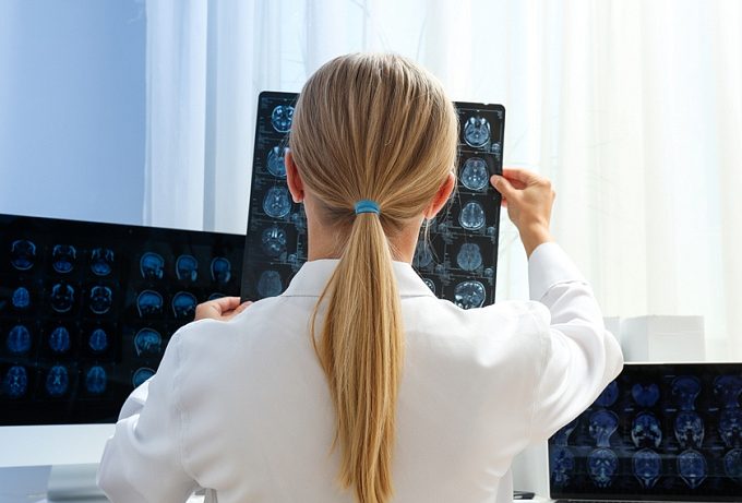 Предикторы выживаемости при ишемическом инсульте на фоне онкологического заболевания ПУБЛИКАЦИИ Предикторы выживаемости при ишемическом инсульте на фоне онкологического заболевания 21 августа 2023 Актуальность  Хорошо известно, что у пациентов с активным онкологическим заболеванием риск инсульта существенно увеличен. Целью данного исследования было изучение факторов, определяющих прогноз пациентов с ишемическим инсультом на фоне онкологического заболевания.  Методы  Проспективное многоцентровое наблюдательное исследование проводилось в Японии. Его участниками были пациенты с острым ишемическим инсультом, который произошел на фоне активного онкологического заболевания. В зависимости от причины инсульта пациенты разделялись на две группы: криптогенный инсульт и инсульт с известной причиной (кардиоэмболический, вызванный окклюзией мелких сосудов и др.). Изучались факторы, ассоциированные с выживаемостью в течение 1 года.  Результаты  В исследовании были проанализированы данные 135 пациентов, перенесших инсульт на фоне активного онкологического заболевания (39% женщины, медиана возраста 75 лет). У 51% участников были отдаленные метастазы.  В 48% случаев инсульт был расценен как криптогенный. Пациенты с криптогенным инсультом характеризовались более короткой выживаемостью (отношение рисков 3.11; 95% доверительный интервал 1.82-5.32).  В многофакторном анализе независимыми предикторами смертельных исходов в течение 1 г. были отдаленные метастазы, уровень д-димера и венозные тромбоэмболические осложнения.  Заключение  Таким образом, у пациентов, перенесших ишемический инсульт на фоне активного онкологического заболевания, независимыми предикторами выживаемости являются наличие отдаленных метастазов, уровень д-димера и венозные тромбоэмболии.