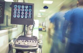 Прогноз пациентов с ишемическим инсультом, получающих антикоагулянтную терапию