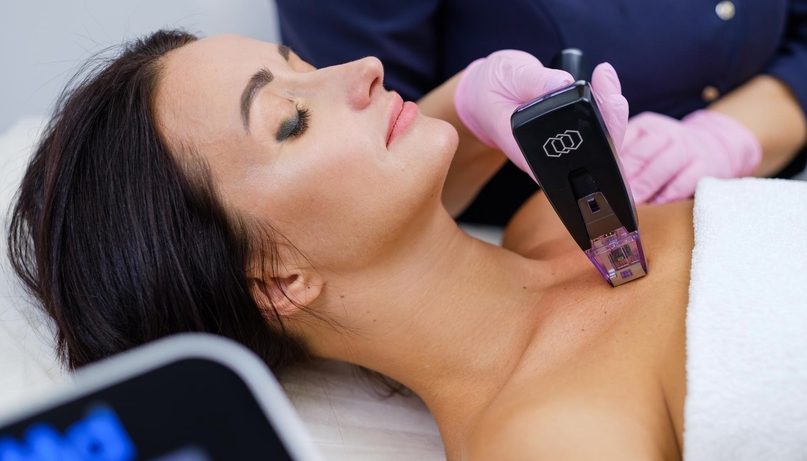 Уникальность процедуры омоложения morpheus 8