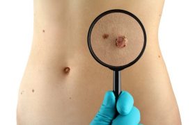 Как вовремя распознать признаки рака?