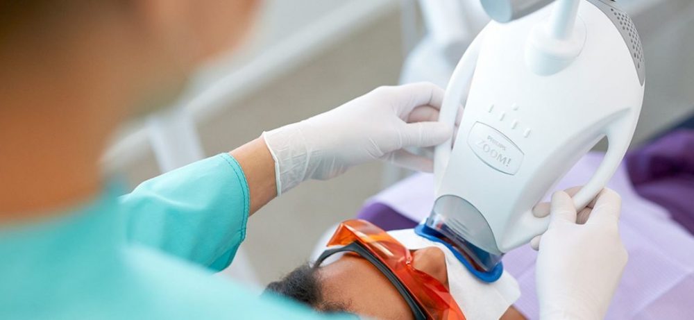 Как долго сохраняется эффект после отбеливания Zoom 4