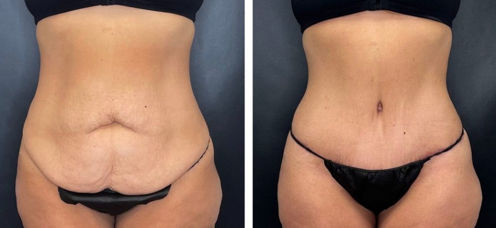 Популярные пластические операции: восстановление формы и уверенности