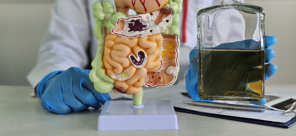 Всего одна пьянка вызывает «синдром дырявого кишечника»