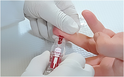 Анализ крови ребенку: когда и зачем назначают исследование