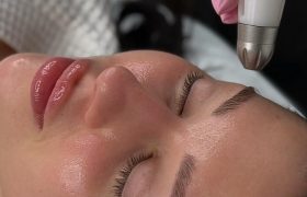 Косметология для преображения кожи лица: как получить результат без лишнего стресса