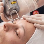 Инъекции или аппарат: как выбрать метод омоложения без лишних иллюзий