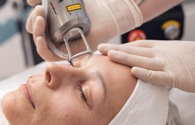 Инъекции или аппарат: как выбрать метод омоложения без лишних иллюзий